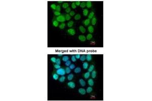 ICC/IF Image Immunofluorescence analysis of paraformaldehyde-fixed A431, using cyclin T2, antibody at 1:200 dilution. (Cyclin T2 antibody  (C-Term))