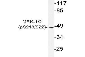 Western blot (WB) analyzes of p-MEK-1/2 antibody in extracts from 293 PMA cells. (MEK1 antibody  (pSer218, pSer222))