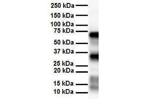 WB Suggested Anti-SLC25A12 antibody Titration: 1 ug/mL Sample Type: Human heart (SLC25A12 antibody  (Middle Region))