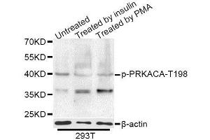 Western blot analysis of extracts of 293T cells,using Phospho-PRKACA-T197 antibody (ABIN5995920) at 1/1000 dilution. (PRKACA antibody  (pThr198))