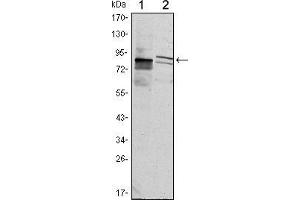 Western blot analysis using KLHL11 mouse mAb against Hela (1) and MCF-7 (2) cell lysate.