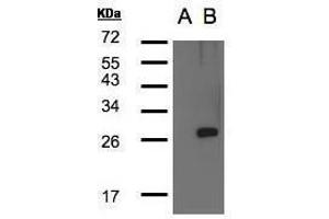 WB Image Western Blot analysis of LYPLA1 expression in transfected 293T cell line by LYPLA1polyclonal antibody. (LYPLA1 antibody)