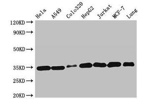 Western Blot Positive WB detected in: Hela whole cell lysate, A549 whole cell lysate, Colo320 whole cell lysate, HepG2 whole cell lysate, Jurkat whole cell lysate, MCF-7 whole cell lysate, Mouse lung tissue All lanes: EMD antibody at 2 μg/mL Secondary Goat polyclonal to rabbit IgG at 1/50000 dilution Predicted band size: 29 kDa Observed band size: 35 kDa (Emerin antibody  (AA 1-222))