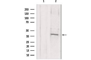 Western blot analysis of extracts from mouse brain, using MAT2B antibody. (MAT2B antibody  (Internal Region))