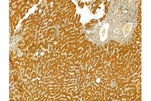 ABIN6265416 and ABIN6273079 at 1/100 staining Human normal tissues adjacent to liver cancer by IHC-P. (SYVN1 antibody  (Internal Region))