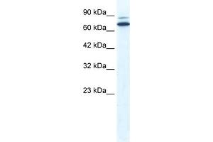 WB Suggested Anti-ZNF57 Antibody Titration:  0. (ZFP57 antibody  (N-Term))
