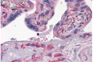 Human Placenta: Formalin-Fixed, Paraffin-Embedded (FFPE) (GBP1 antibody  (AA 1-593))