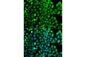 Immunofluorescence analysis of A549 cell using HLA-DRB1 antibody. (HLA-DRB1 antibody)