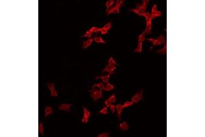 ABIN6274995 staining Hela by IF/ICC. (CBLN2 antibody  (N-Term))
