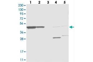 Western blot analysis of Lane 1: RT-4, Lane 2: U-251 MG, Lane 3: Human Plasma, Lane 4: Liver, Lane 5: Tonsil with OLA1 polyclonal antibody  at 1:250-1:500 dilution.