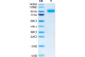 Human IL-1 Rrp2 on Tris-Bis PAGE under reduced condition. (IL1RL2 Protein (AA 20-335) (Fc Tag))