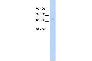 WB Suggested Anti-ARIH1 Antibody Titration:  1. (ARIH1 antibody  (C-Term))
