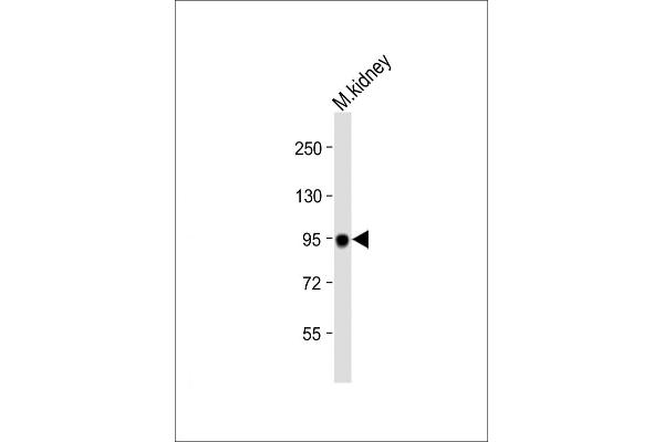 MEP1A anticorps  (N-Term)