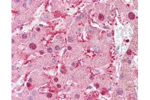 Immunohistochemical staining (Formalin-fixed paraffin-embedded sections) of human liver with AKR1C1 monoclonal antibody, clone AT6D10 . (AKR1C1 antibody)