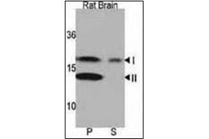 Western blot analysis of LC3 Antibody in Rat brain lysate.