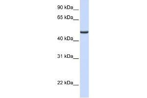 FDXR antibody used at 1 ug/ml to detect target protein. (Ferredoxin Reductase antibody  (Middle Region))