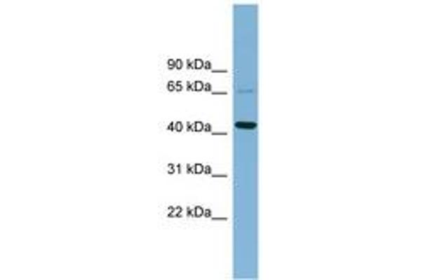 UEVLD antibody  (AA 143-192)