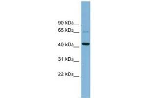 Image no. 1 for anti-UEV and Lactate/malate Dehyrogenase Domains (UEVLD) (AA 143-192) antibody (ABIN6742158) (UEVLD antibody  (AA 143-192))