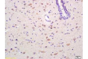 Formalin-fixed and paraffin embedded rat brain labeled with Rabbit Anti EPH receptor A4 Polyclonal Antibody, Unconjugated (ABIN734123) at 1:200 followed by conjugation to the secondary antibody and DAB staining (EPH Receptor A4 antibody  (AA 531-630))