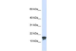 WB Suggested Anti-TMEM166 Antibody Titration:  0.