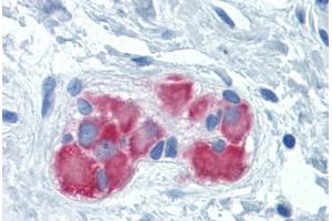 Human Colon, submucosal plexus: Formalin-Fixed, Paraffin-Embedded (FFPE) (FARSB antibody  (AA 234-342))