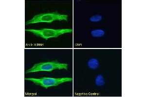 ABIN6391378 Immunofluorescence analysis of paraformaldehyde fixed HeLa cells, permeabilized with 0. (KCNN4 antibody  (Internal Region))