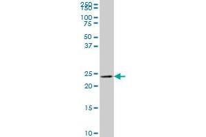 MYL6B antibody  (AA 109-208)