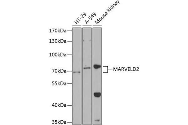 Tricellulin antibody  (AA 1-195)