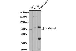 Western blot analysis of extracts of various cell lines, using M antibody  at 1:1000 dilution. (Tricellulin antibody  (AA 1-195))