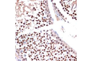 Immunohistochemistry of paraffin-embedded rat testis using NUP153 Rabbit mAb (ABIN1512527, ABIN3023298, ABIN3023299 and ABIN7101477) at dilution of 1:100 (40x lens). (NUP153 antibody)