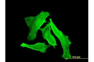 Immunofluorescence of monoclonal antibody to GUCY2D on HeLa cell. (GUCY2D antibody  (AA 521-630))