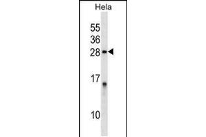 Western Blotting (WB) image for anti-Protein Phosphatase 1, Regulatory (Inhibitor) Subunit 2 (PPP1R2) (AA 119-148) antibody (ABIN5535653)