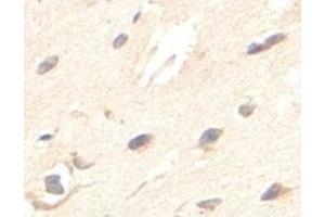 Immunohistochemical analysis of paraffin-embedded human fetal brain showing cytoplasmic staining with ZBED5 polyclonal antibody  at a 1 : 100 dilution. (ZBED5 antibody  (AA 224-474))