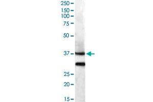 MC5R polyclonal antibody  (0. (MC5 Receptor antibody)