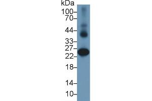 Detection of GSTa2 in Human Liver lysate using Polyclonal Antibody to Glutathione S Transferase Alpha 2 (GSTa2) (GSTa2 antibody  (AA 1-222))