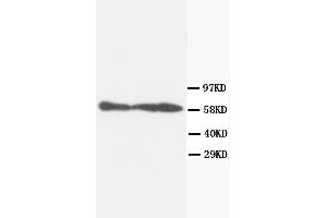 Western Blotting (WB) image for anti-Protein Phosphatase 3, Catalytic Subunit, alpha Isoform (PPP3CA) antibody (ABIN1108716) (PPP3CA antibody)