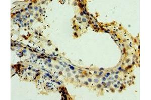 Immunohistochemistry of paraffin-embedded human testis tissue using ABIN7159272 at dilution of 1:100 (MAGEA6 antibody  (AA 75-314))