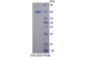 SDS-PAGE (SDS) image for Tryptophanyl tRNA Synthetase 2, Mitochondrial (WARS2) (AA 1-360) protein (His tag) (ABIN4990271) (WARS2 Protein (AA 1-360) (His tag))
