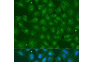 Immunofluorescence analysis of U2OS cells using ZBTB20 Polyclonal Antibody at dilution of 1:100. (ZBTB20 antibody)