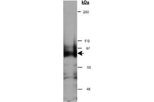 Western blot analysis of CYTSB in HeLa whole cell lysate (RIPA) using CYTSB polyclonal antibody  at 0. (NSP5 antibody  (AA 1-100))
