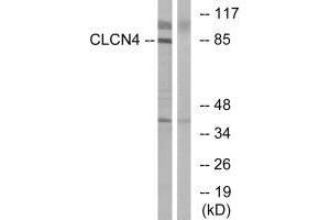 Western blot analysis of extracts from MCF-7 cells, using CLCN4 antibody. (CLCN4 antibody)