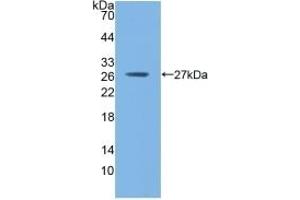Detection of Recombinant GSTm1, Mouse using Polyclonal Antibody to Glutathione S Transferase Mu 1 (GSTM1) (GSTM1 antibody  (AA 1-218))