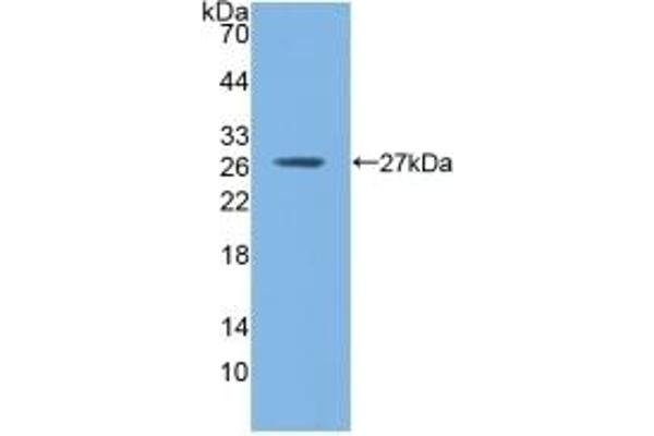 GSTM1 anticorps  (AA 1-218)