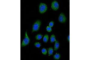 Confocal immunofluorescent analysis of CFH Antibody (Center) with A549 cell followed by Alexa Fluor® 489-conjugated goat anti-rabbit lgG (green). (Complement Factor H antibody  (Middle Region))