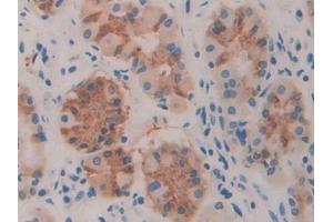 DAB staining on IHC-P; Samples: Human Stomach Tissue (TLR3 antibody  (AA 574-713))