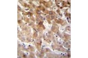 Immunohistochemistry analysis in formalin fixed and paraffin embedded human liver tissue reacted with MBTD1 Antibody (C-term) followed which was by peroxidase conjugated to the secondary antibody and followed by DAB staining. (MBTD1 antibody  (C-Term))