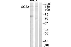 Western blot analysis of extracts from K562 cells and Jurkat cells, using SOS2 antibody. (SOS2 antibody  (Internal Region))