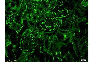 Formalin-fixed and paraffin embedded mouse kidney labeled with Anti-C3 Polyclonal Antibody, Unconjugated (ABIN681913) at 1:200 followed by conjugation to the secondary antibody Goat Anti-Rabbit IgG, FITC conjugated used at 1:200 dilution for 40 minutes at 37°C (C3 antibody  (AA 1551-1663))