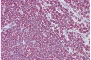 Anti-CD40LG / CD54 antibody IHC staining of human thymus. (CD40 Ligand antibody  (AA 108-157))