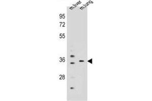 Western blot analysis of KCNRG Antibody (C-term) in mouse liver,lung tissue lysates (35ug/lane). (KCNRG antibody  (C-Term))
